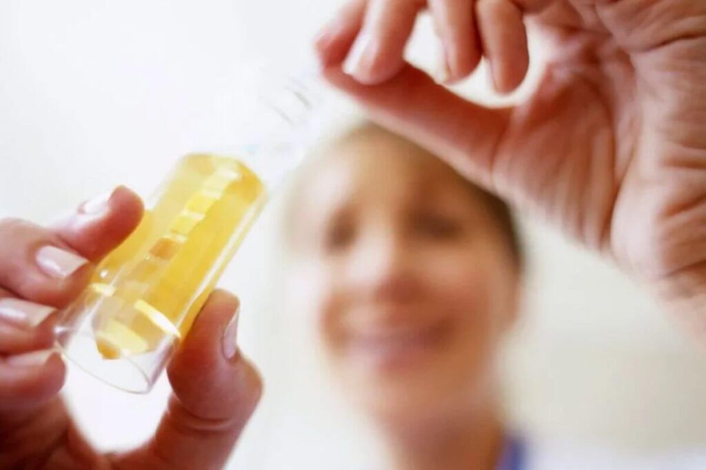 Diagnostic cancer vessie